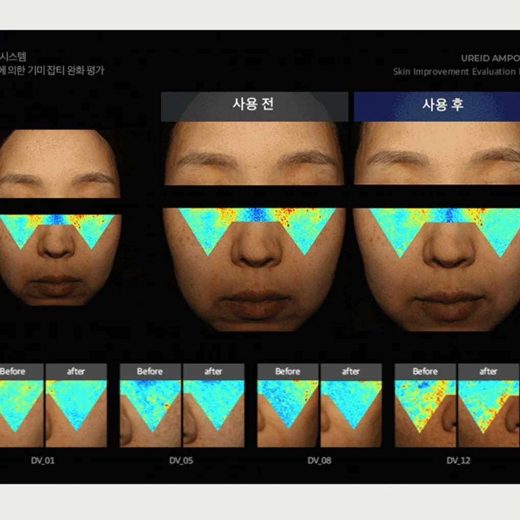 비에논 우레이드 기미앰플 검버섯 흑자 나이아신아마이드 미백앰플 상세 이미지 2