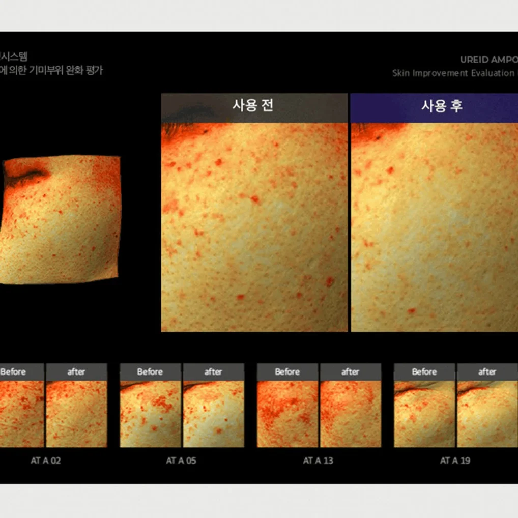 비에논 우레이드 기미앰플 검버섯 흑자 나이아신아마이드 미백앰플 상세 이미지 3
