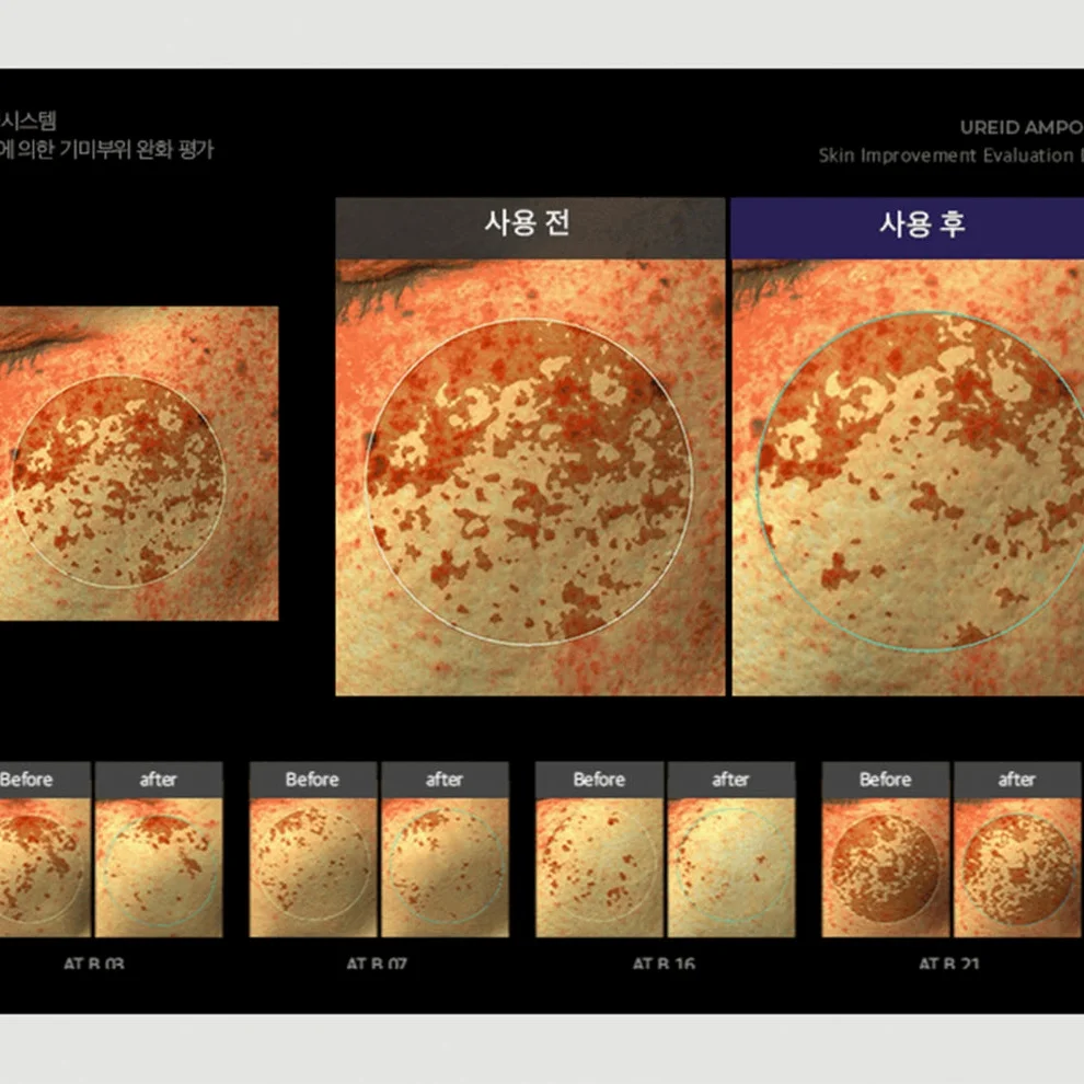 비에논 우레이드 기미앰플 검버섯 흑자 나이아신아마이드 미백앰플 상세 이미지 5